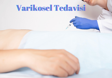 varikosel-tedavisi