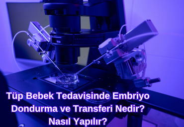 tup-bebek-tedavisinde-embriyo-dondurma-ve-transferi-nedir-nasil-yapilir