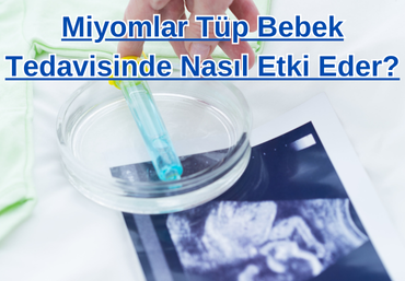miyomlar-tup-bebek-tedavisinde-nasil-etki-eder